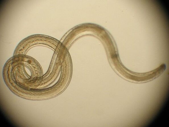 Trichinella mar speiceas de parasite daonna