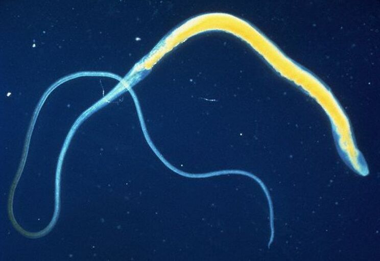 Is parasite intestinal coitianta é whipworm.