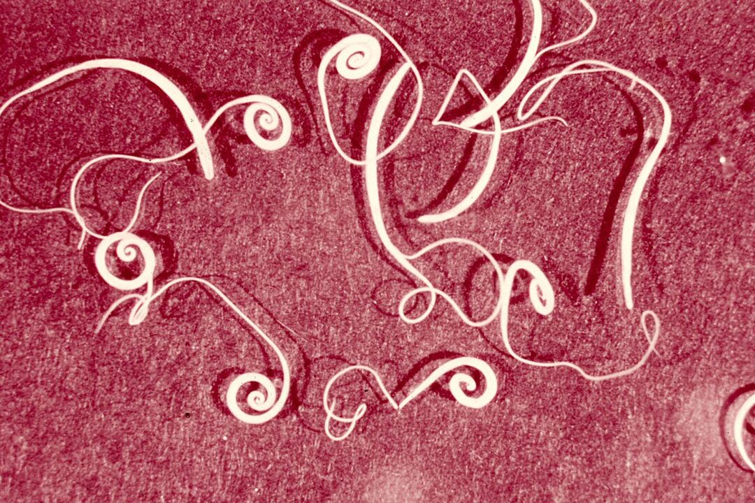 péisteanna trichinella daonna