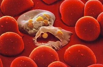 plasmodium maláire i gcorp an duine